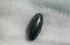 City docs use a magnet to remove one swallowed by girl
